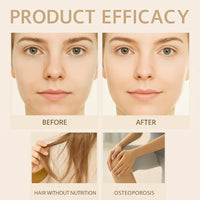 Berryskin Hyaluronic Acid Powder™ -- 1000 Servings