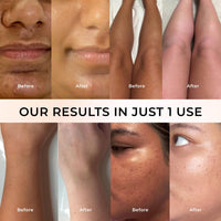 BerrySkin™ Kojic-Gluta Instant Tan Clear Polish