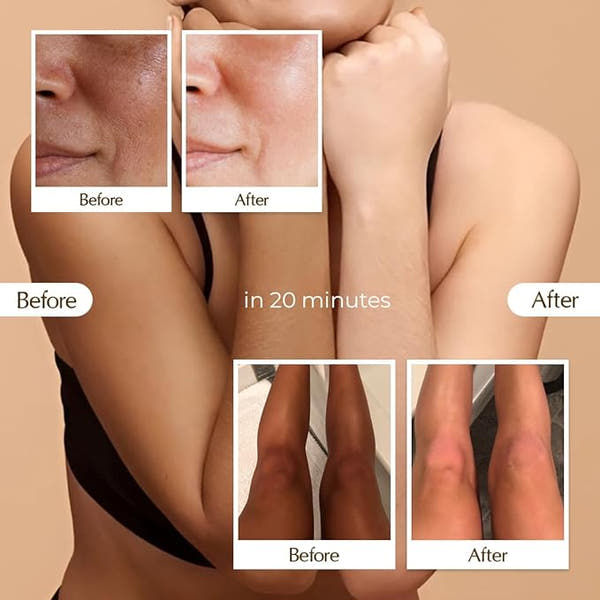 BerrySkin™ Purifying Exfoliating Gel