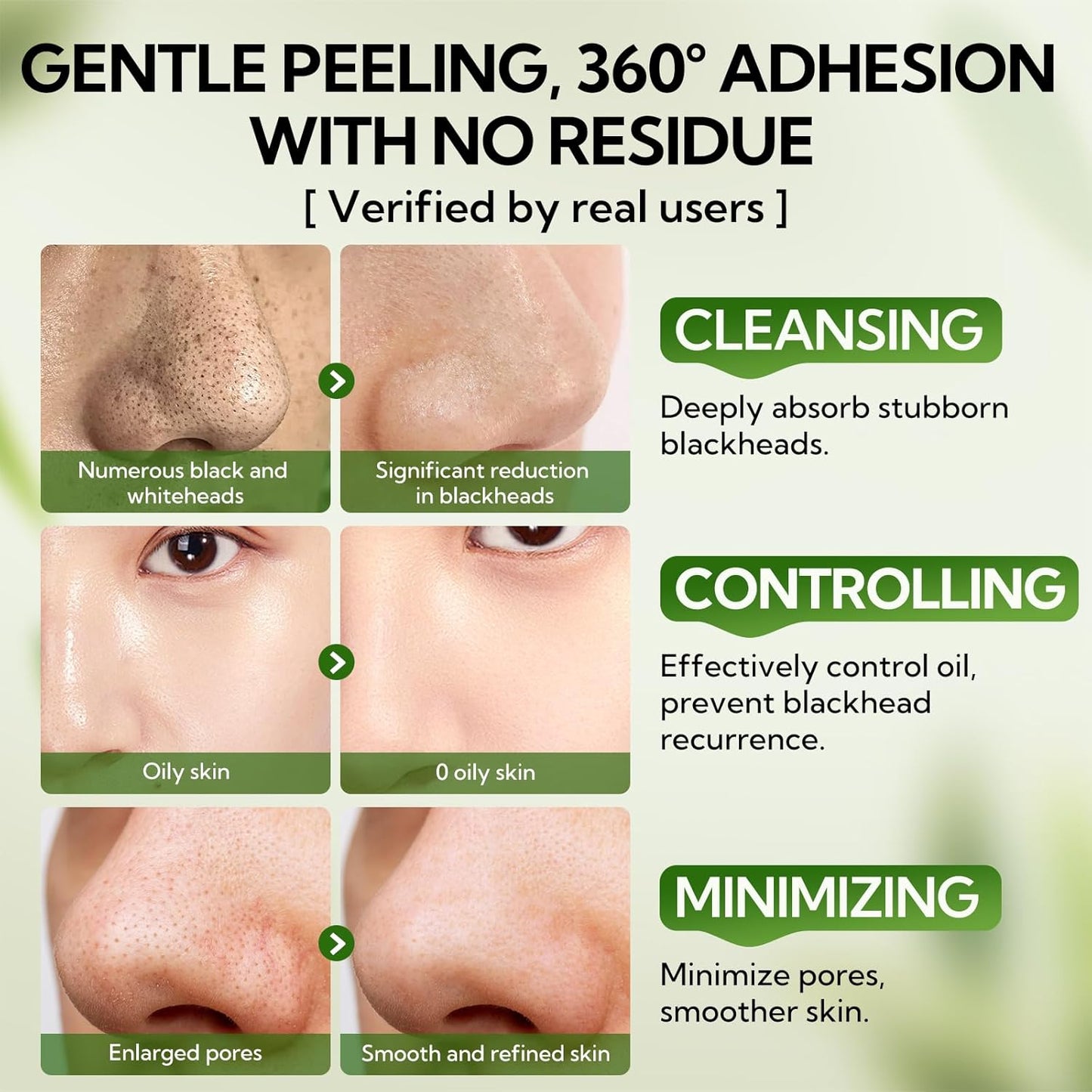 Clear Skin 2.0 Blackhead Clear Mask with 100 Strips™