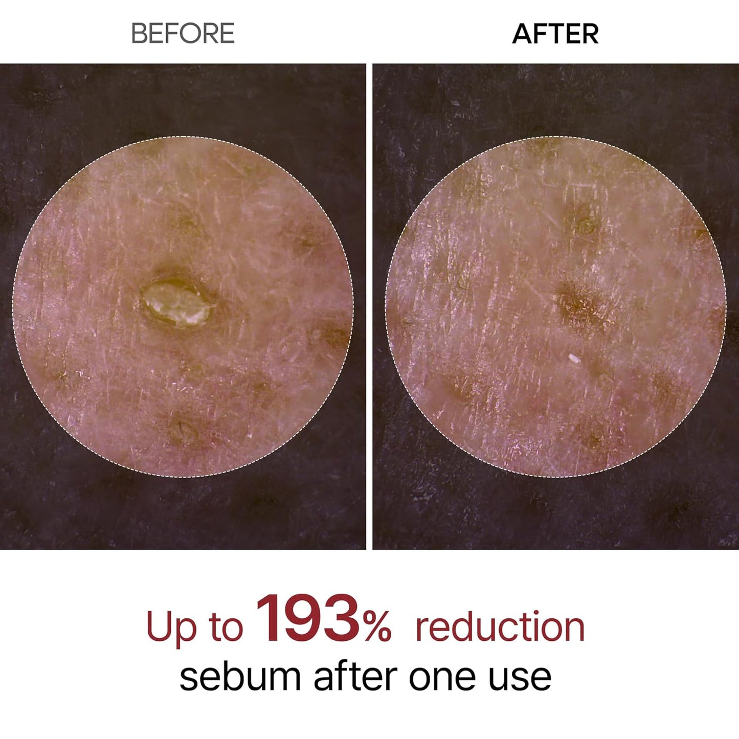 BerrySkin Peel Shot Glow™