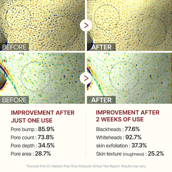 BerrySkin Peel Shot Glow™