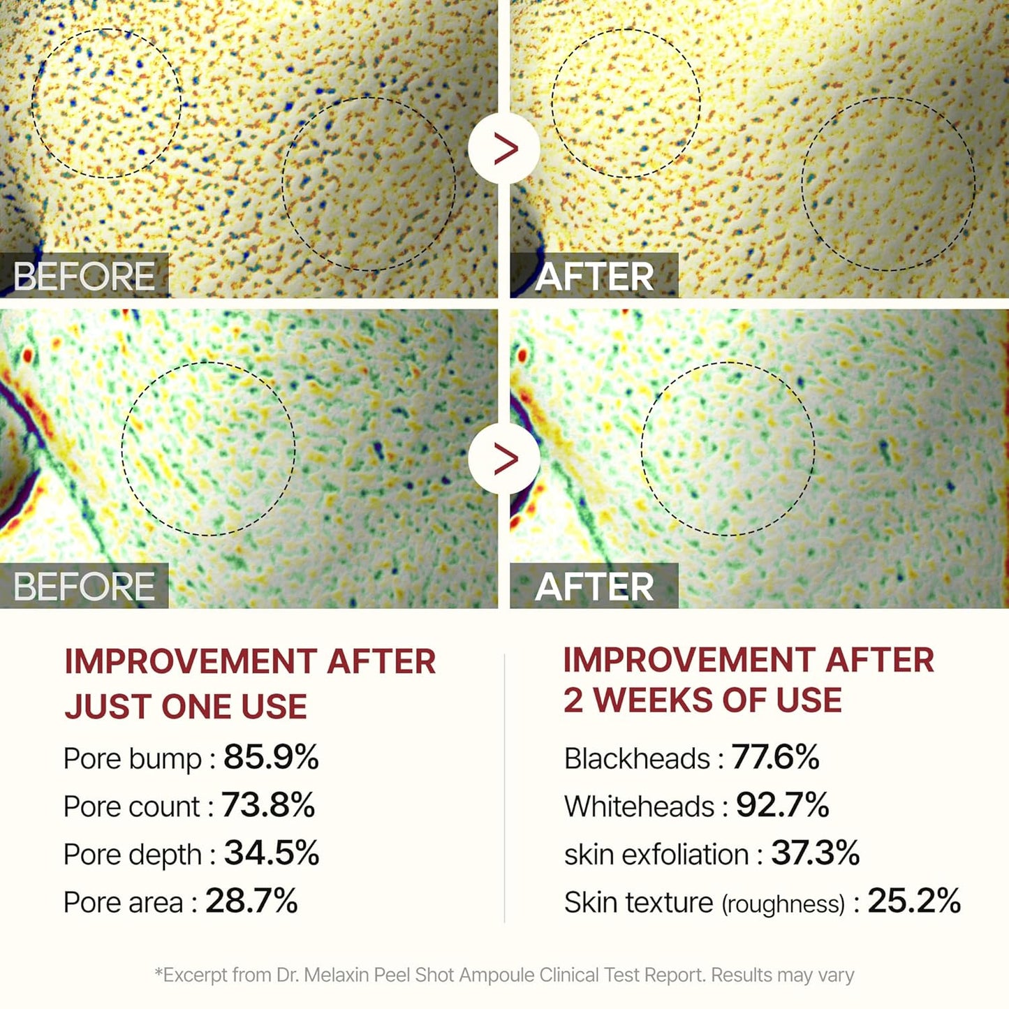 BerrySkin Peel Shot Glow™