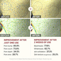 BerrySkin Peel Shot Glow™