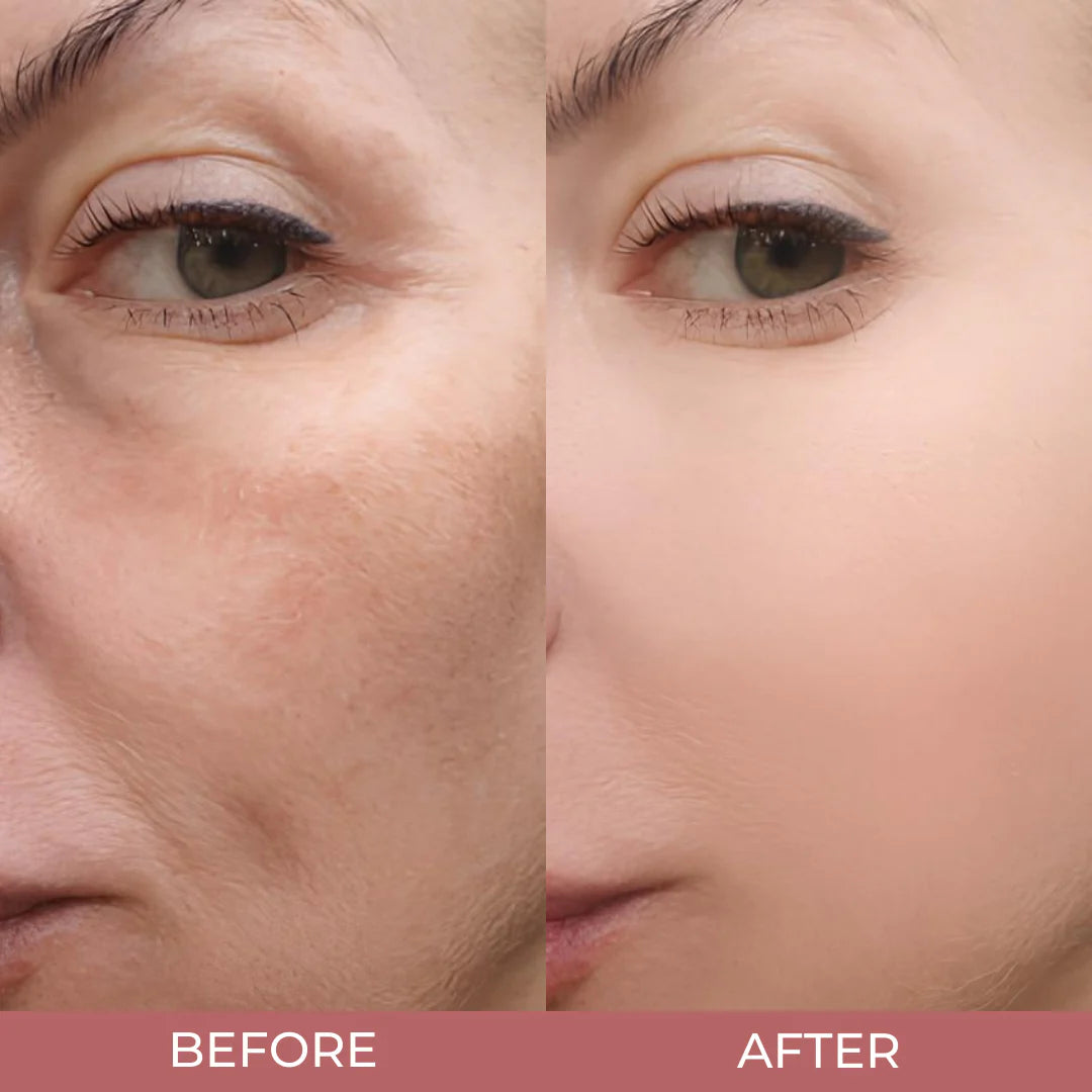 BerrySkin Peel Shot Glow™