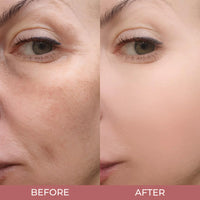 BerrySkin Peel Shot Glow™